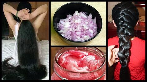 How To Stop Hair Loss And Regrow Hair Naturally Home Remedies Natural