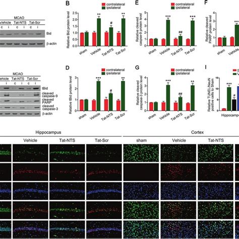 Tat NTS Peptide Alleviates Ischemia Induced Neuronal Apoptosis