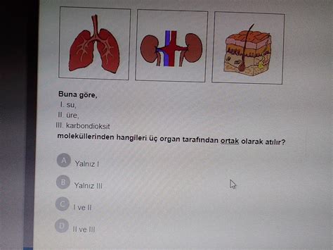 Bu Soruyu Anlatarak Cevaplayabilir MisiniZ Eodev