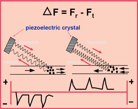 Principles Of Doppler Ultrasound Flashcards Quizlet