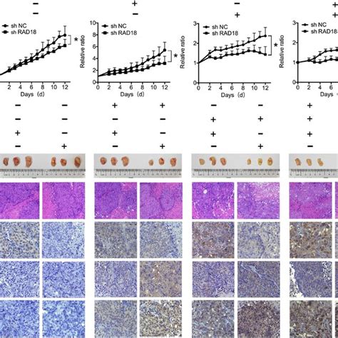 Expression Of Rad In Pretreatment Biopsy Specimens Indicated