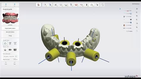 3shape Implant Studio Being Successful With The Dual Ct Scan Protocol