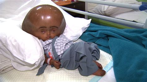 The Biggest Head In The World That Is A Human