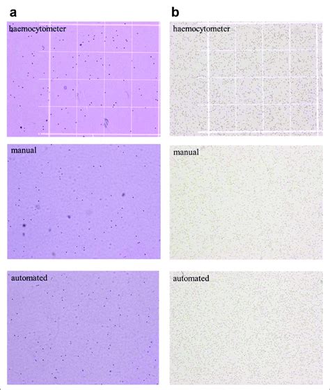 Visual Comparisons Of Hemocytometer Manual Cartridge And Automated