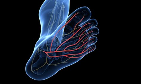 Does The Ssa Consider Neuropathy A Disability