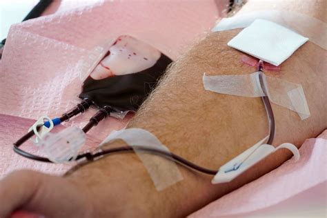 Fda Drops Blood Donation Restrictions Specific To Gay And Bisexual Men