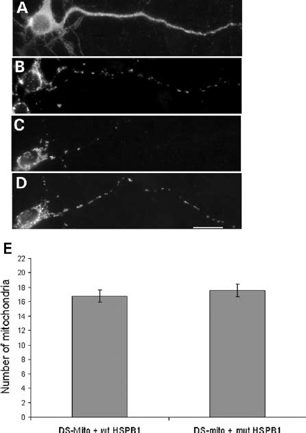 Expression Of Mutant Hspb Has No Effect On Synaptotagmin Distribution