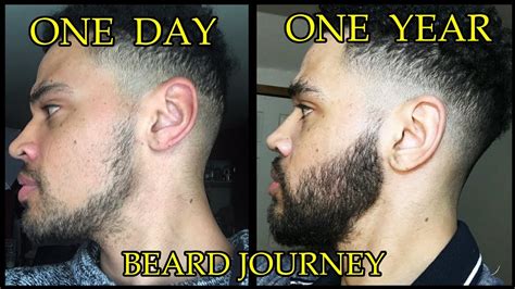 One Year Transformation My Minoxidil Beard Journey Whats To Come In