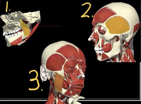 Bite Splints And Occlusion Flashcards Quizlet