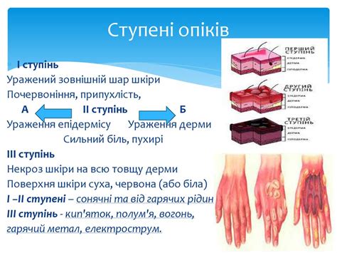 Опіки. Домедична допомога в разі термічних і хімічних опіків ...