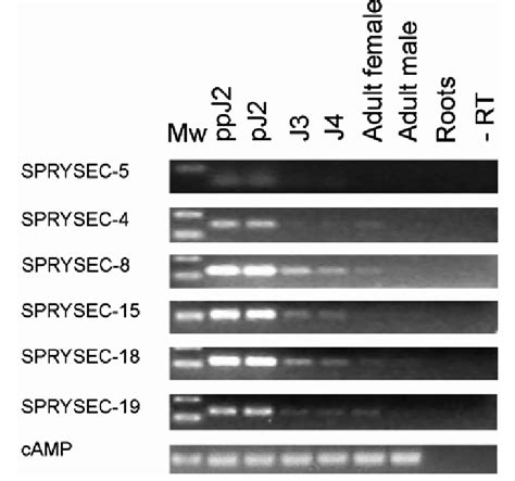 Semiquantitative Reverse Transcriptase Polymerase Chain Reactions With Download Scientific