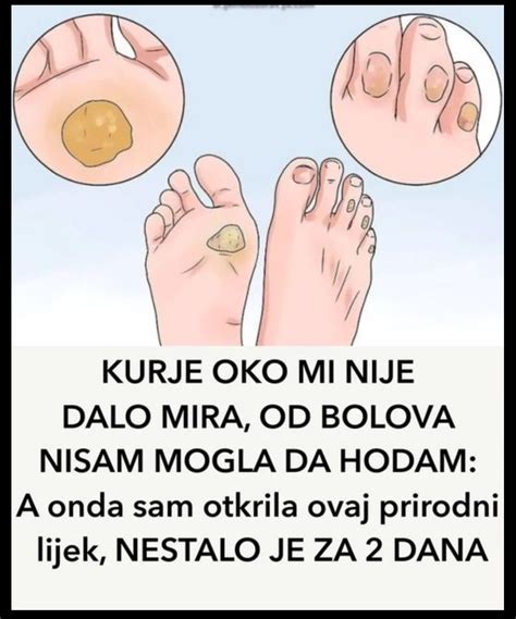 KURJE OKO MI NIJE DALO MIRA OD BOLOVA NISAM MOGLA DA HODAM A Onda Sam