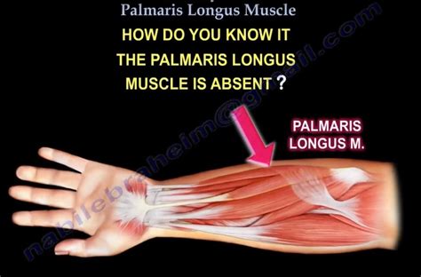 Anatomy Of Palmaris Longus OrthopaedicPrinciples