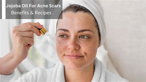 How To Use Jojoba Oil To Treat Acne Scars