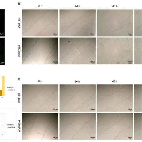 In Vitro Migration Of Wm And Wm Human Melanoma Cells Depends On