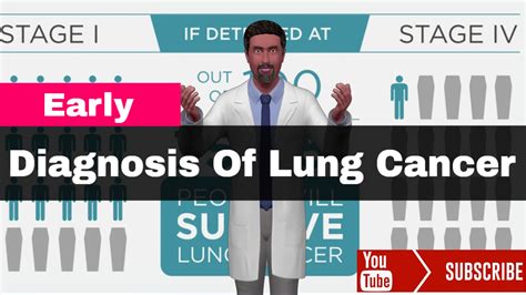 Early Diagnosis Of Lung Cancer Male Health Clinic