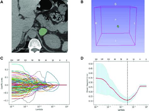 Delineation Of Voi And Selection Of Radiomic Features A Delineation Download Scientific