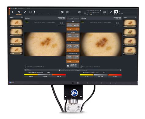 FotoFinder AI Moleanalyzer Pro FotoFinder Systems