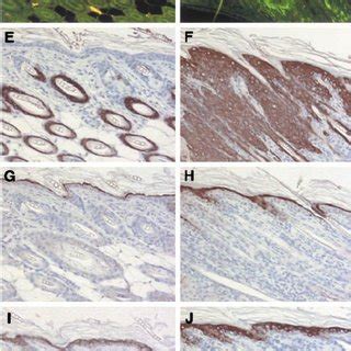 Histological Analysis Of TPA Induced Epidermal Hyperplasia In The