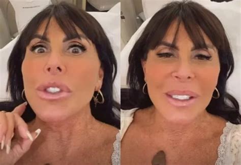 Gretchen Chamada De Aberra O Ap S Harmoniza O Facial E Fica