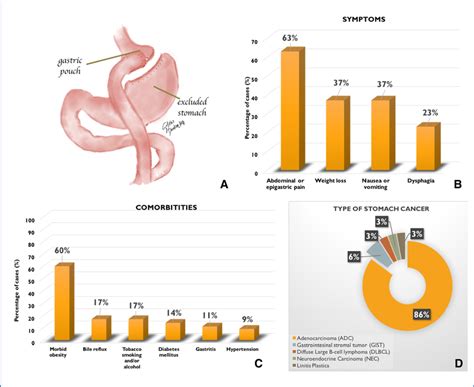 A Representation Of Roux En Y Gastric Bypass Rygb And Percentages