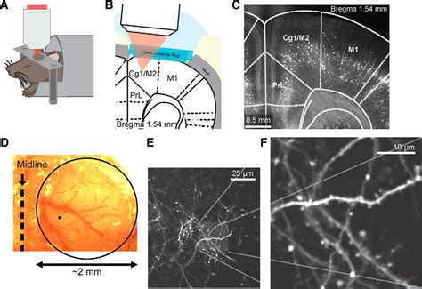 Longitudinal Effects Of Ketamine On Dendritic Architecture In Vivo In