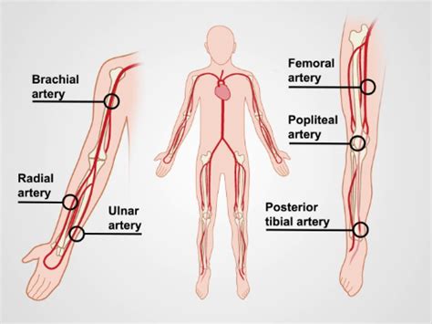 Peripheral Vascular Exam Using A Continuous Wave Doppler Video Jove