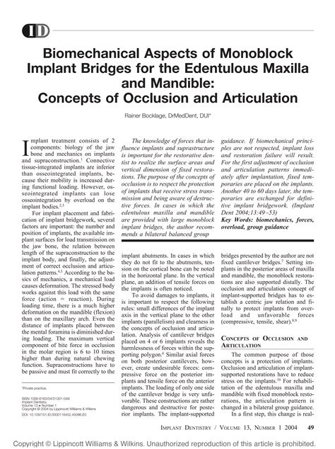 Biomechanical aspects of monoblock implant bridges for the edentulous