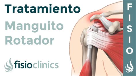 Lesi N Del Manguito Rotador Qu Es Diagn Stico Y Tratamiento