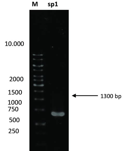 Pcr Amplification Of The Gene 16s Rrna With Primers 63f And 1387r