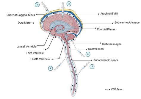 Normal Human CSF Circulation And Types Of CSF Injections CSF Is