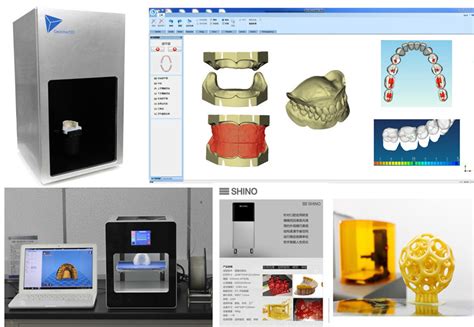 我院首次应用自主研发的3d打印技术成功完成无牙颌全口义齿修复 新闻动态