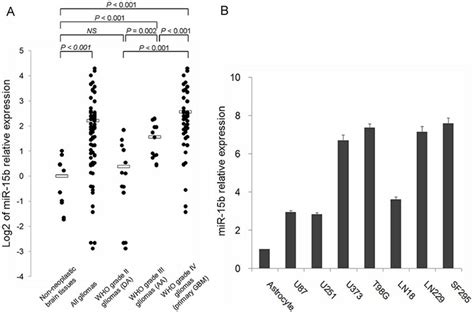 MiR 15b Expression In 76 Glioma Tissues 50 Primary GBMs 13 AAs And 13