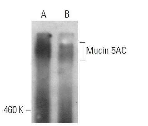 Mucin 5AC MUC5AC抗体 A 5 SCBT Santa Cruz Biotechnology