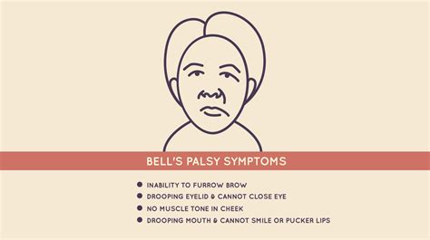 Bouncing Back From Bell’s Palsy