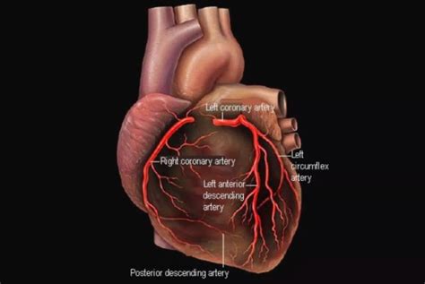 arteri koroner  penyakit jantung sekolah