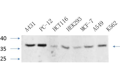 Anti Cebp Beta Antibody A95167