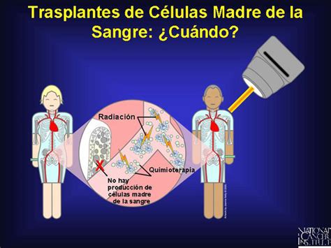 Trasplante De C Lulas Madre Y Trasplantes De M Dula Sea Gu A De La