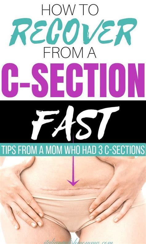 How To Recover From A C Section Fast Wondering How You Can Quickly