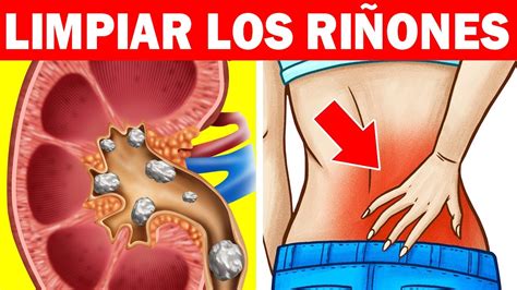 Sintomas De Ri Ones Enfermos C Lculos E Insuficiencia Renal