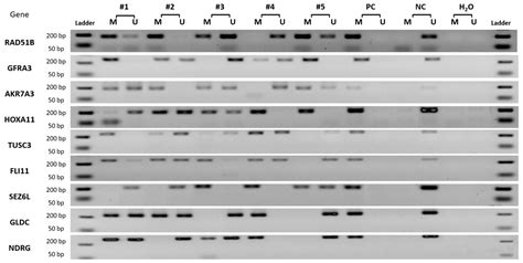 Dna Methylation Of Hoxa11 Gene As Prognostic Molecular Marker In Human