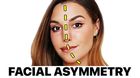 Marzia's 'Facial Asymmetry' | Surgeon Reacts :: GentNews