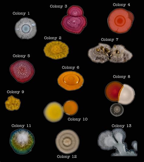 Solved Describe Fully The Colonial Morphology Of The Chegg