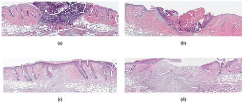 Above: Histology of (a) TIEG −/− mice and (b) controls at postoperative... | Download Scientific ...