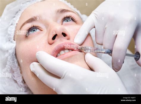 Lip Injection Procedure Lips Filler Young Woman Stock Photo Alamy
