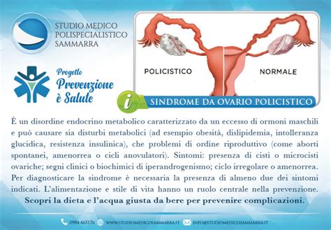 La Sindrome Dellovaio Policistico PCOS Studio Medico Sammarra