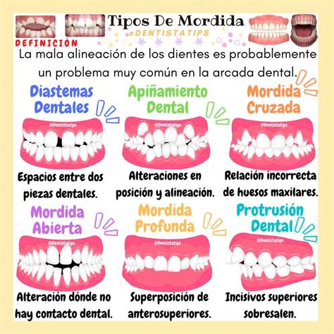 Oclusi N Tipos De Mordida Maloclusion En Escuela De Higiene