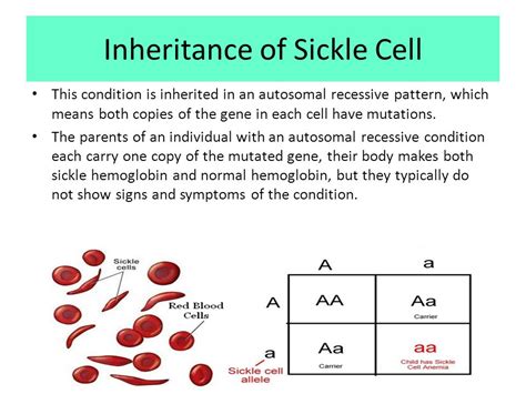 Sickle Cell Anemia Inheritance