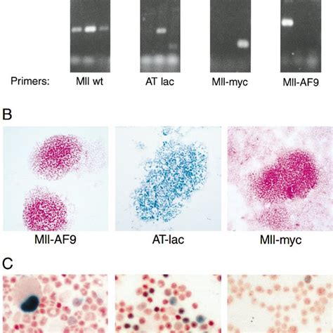 Pdf An Mllaf9 Fusion Gene Made By Homologous Recombination Causes