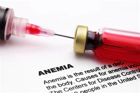 Megaloblastic Macrocytic Anemia - Net Health Book